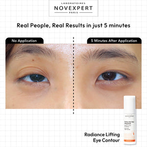 Radiance Lifting Eye Contour  Vitamin C anti-aging eye care – Novexpert